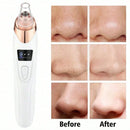 Vayb Electric Pore Cleanser Vacuum for Deep Facial Care