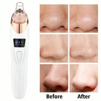 Vayb Electric Pore Cleanser Vacuum for Deep Facial Care