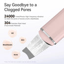 Vayb Anlan Ultrasonic Skin Scrubber for Deep Facial Cleaning