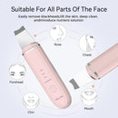 Vayb Anlan Ultrasonic Skin Scrubber for Deep Facial Cleaning