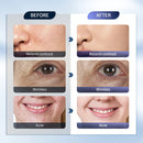 Vayb 7-Color LED Face Mask with Nano Mist for Skin Rejuvenation